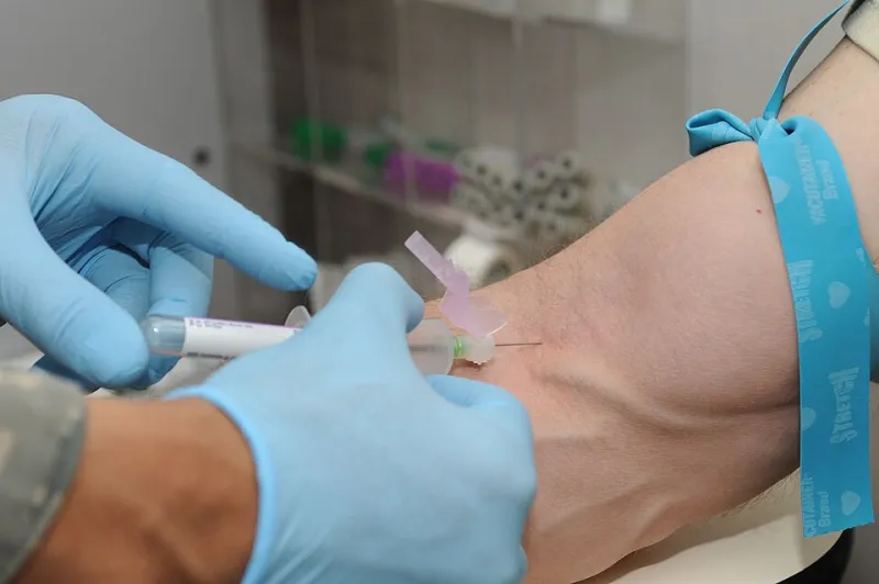 When the Numbers Say Fine but Your Body Says Otherwise: Decoding the Lab Test Gap on Prednisone